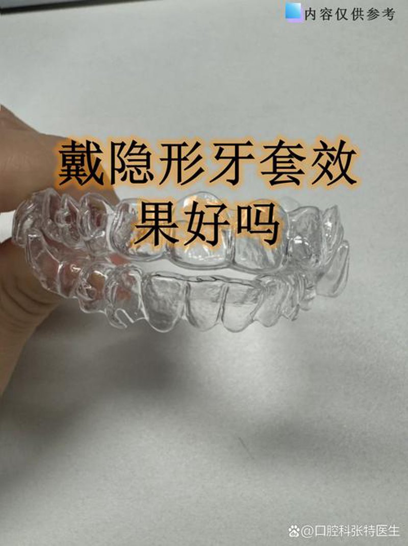 隐形矫正：以舒适之名重塑美丽牙齿